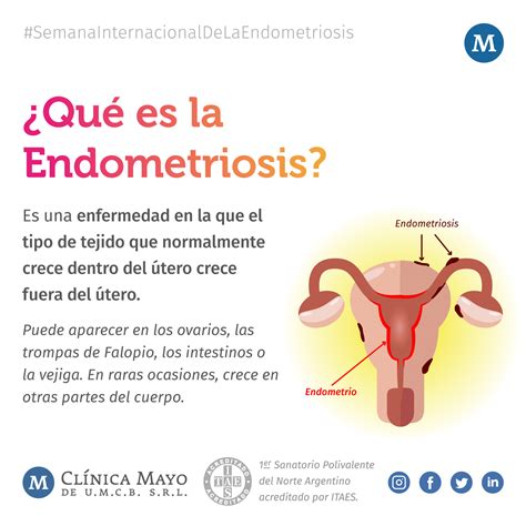 que es la endometriosis